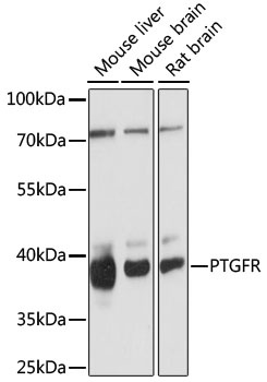 PTGFR Antibody