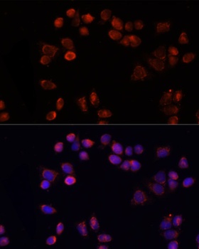 SLC25A4 Antibody