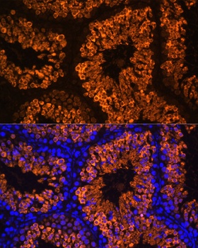LDHC Antibody