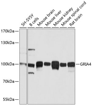 GRIA4 Antibody