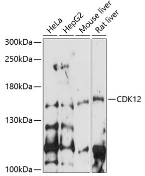 CDK12 Antibody