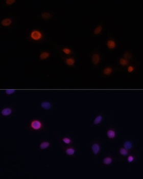 CDKN1A Antibody
