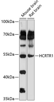 HCRTR1 Antibody