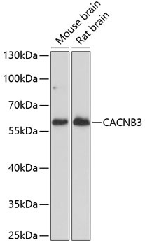 CACNB3 Antibody