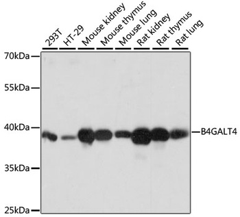 B4GALT4 Antibody