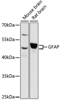 GFAP Antibody