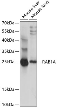 RAB1A Antibody