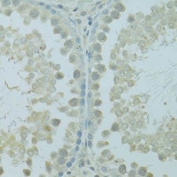 HUS1B Antibody