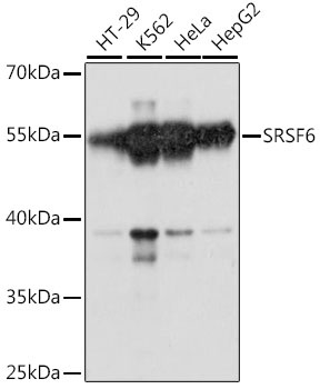 SRSF6 Antibody
