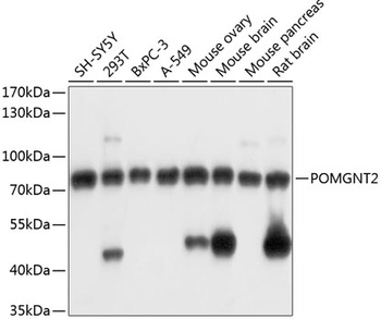 POMGNT2 Antibody