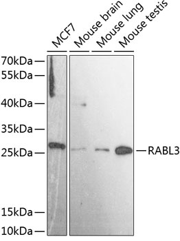 RABL3 Antibody
