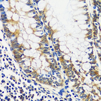 CCDC124 Antibody