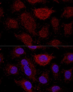 RPL21 Antibody