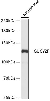 GUCY2F Antibody