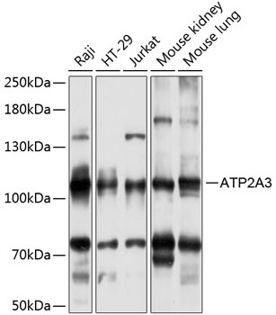 ATP2A3 Antibody