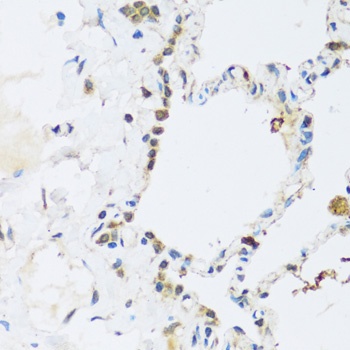 ATP2A3 Antibody