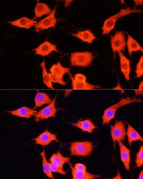 SERPINA12 Antibody