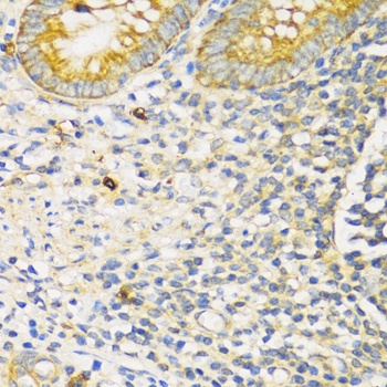 TGFBR2 Antibody