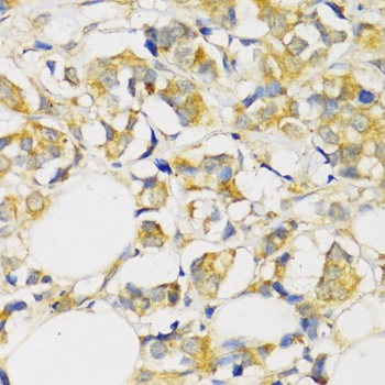 TGFBR2 Antibody