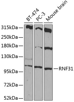 RNF31 Antibody
