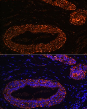 RNF31 Antibody