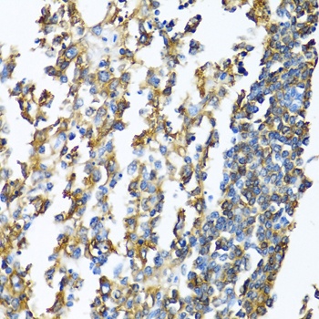 HLA-DPB1 Antibody