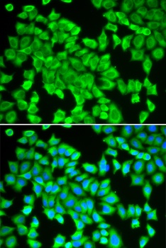 STIP1 Antibody