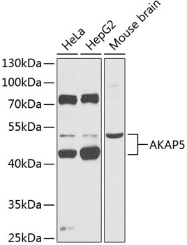 AKAP5 Antibody