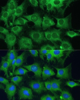 PTPN22 Antibody