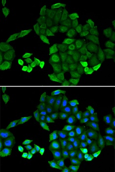 PTS Antibody