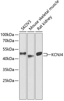 KCNJ4 Antibody