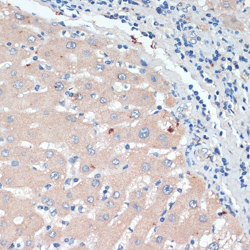 DBH Antibody