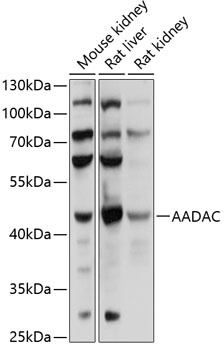 AADAC Antibody