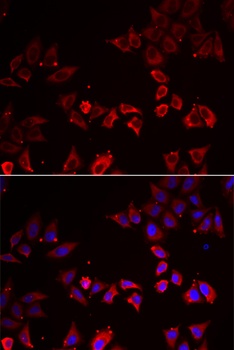 LIMS1 Antibody