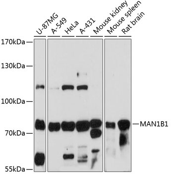 MAN1B1 Antibody