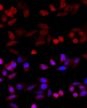 CYP1B1 Antibody