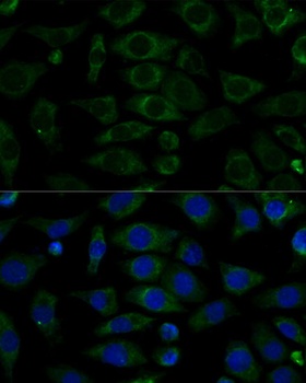 NDUFB7 Antibody
