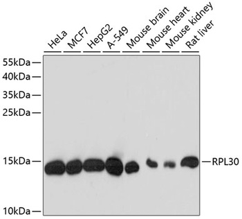 RPL30 Antibody