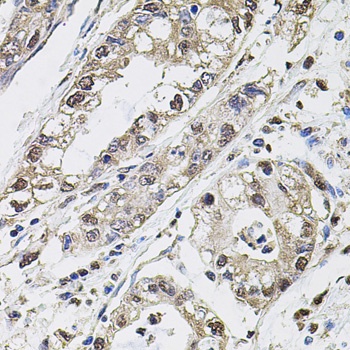 CA9 Antibody
