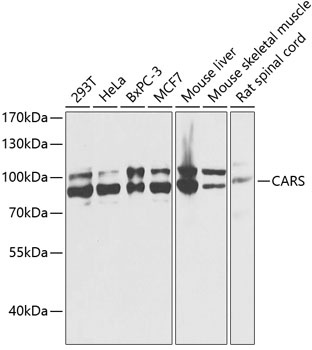 CARS Antibody