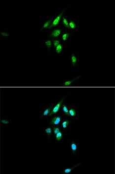 NR3C1 Antibody