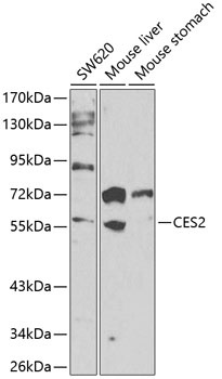 CES2 Antibody
