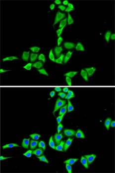 CES2 Antibody