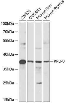 RPLP0 Antibody