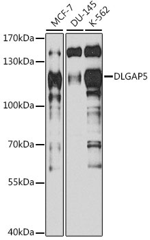 DLGAP5 Antibody