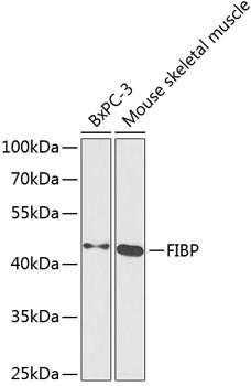 FIBP Antibody