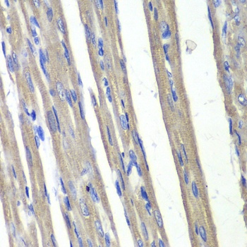 AKR1C3 Antibody