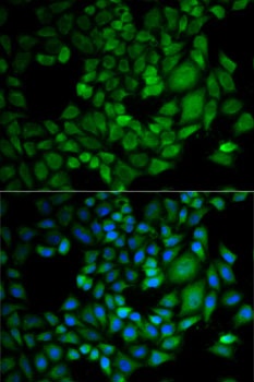 AKR1C3 Antibody