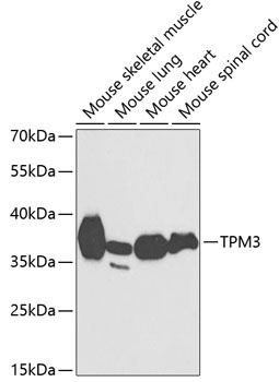 TPM3 Antibody