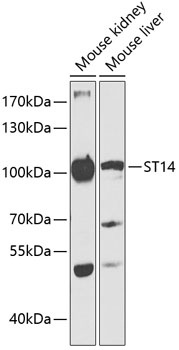 ST14 Antibody